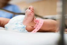 الولادة المبكرة Premature Birth.. الأسباب والمخاطر وطرق الوقاية
