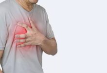 الذبحة الصدرية Angina.. الأنواع والأسباب