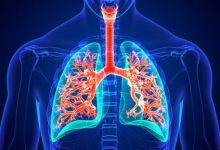 مرض الأسبيست Asbestosis.. الأعراض والتشخيص والعلاج