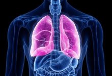 مرض الرئة الخلالي Interstitial Lung Disease.. الأسباب وطرق العلاج