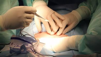 العملية القيصرية (C-Section).. كل ما تحتاج معرفته