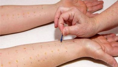 اختبار حساسية الجلد (Allergy Skin Test).. أهمية وطريقة إجراء الفحص