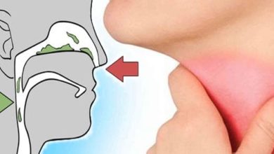 بكتيرية أم فيروسية.. كيف يشير لون المخاط إلى نوع العدوى؟