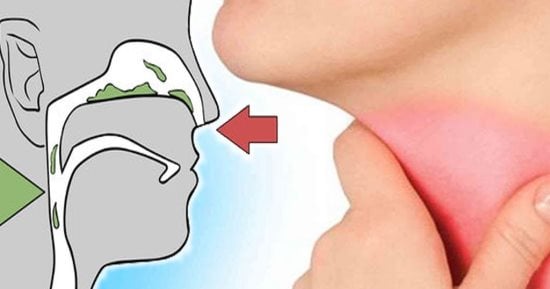 بكتيرية أم فيروسية.. كيف يشير لون المخاط إلى نوع العدوى؟