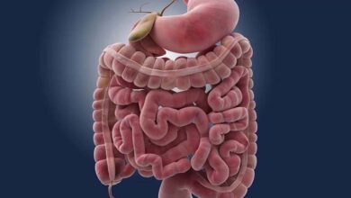 أعراض خفية قد تكشف سرطان الأمعاء.. خبراء يحذرون من تجاهل العلامات المبكرة