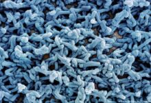 إثيوبيا تسجل أول حالة جديدة بفيروس ماربورغ منذ 10 أيام.. وارتفاع الإصابات إلى 14