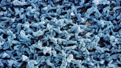 إثيوبيا تسجل أول حالة جديدة بفيروس ماربورغ منذ 10 أيام.. وارتفاع الإصابات إلى 14