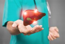 دراسة تكشف تأثير السوربيتول على صحة الكبد