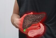 الولايات المتحدة تنهي إلزام تطعيم المواليد الجدد ضد التهاب الكبد B وتترك القرار للآباء