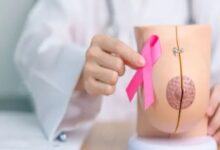 دراسة: ربع حالات سرطان الثدي تصيب نساءً دون سن الخمسين وتكشف فجوة في إرشادات الفحص
